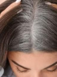 White Hair Problem Home Remedies